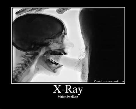 blowjob xray|Blowjob XRay deepthroat .